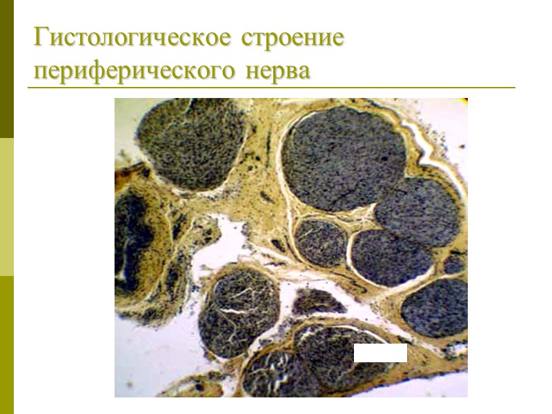 Гистологическое строение периферического нерва